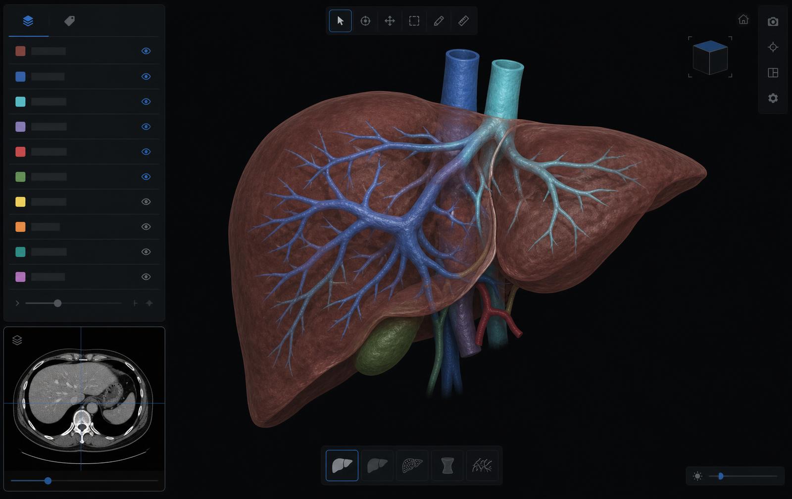 SPview software interface showing an interactive 3D liver reconstruction with structure visibility controls and a CT slice viewer